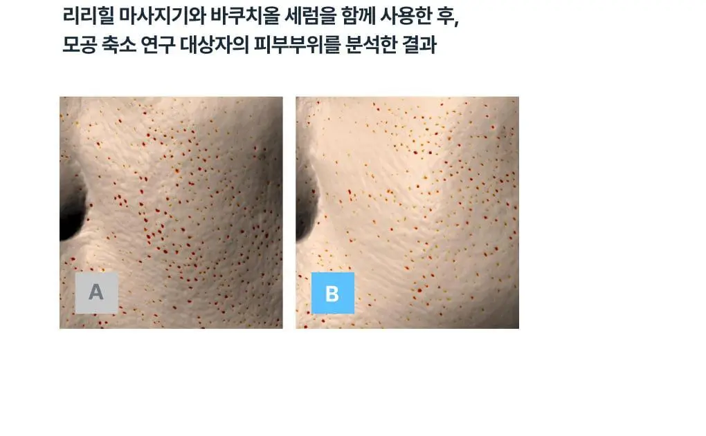 [보습개선/진정]반코르 바쿠치올 5000ppm 모공결 주름결 세럼 슬로우에이징 상세페이지 19
